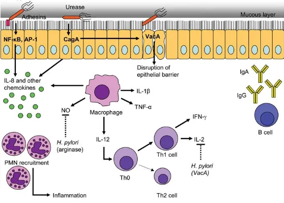 Gambar 2.3. Imunopatogenesis infeksi H.pylori  14 