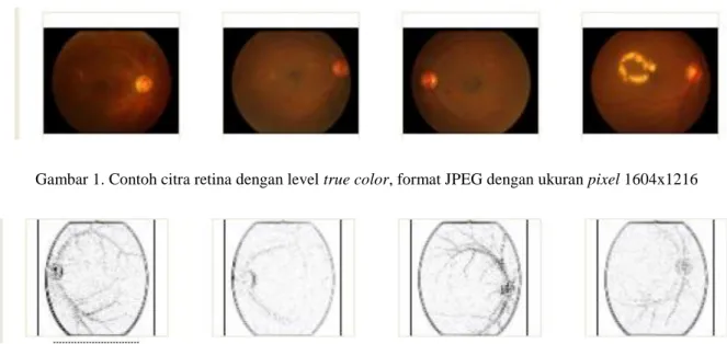 Gambar 1. Contoh citra retina dengan level true color, format JPEG dengan ukuran pixel 1604x1216 