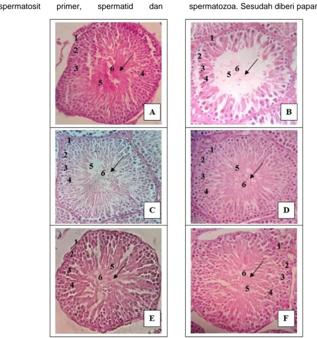 Gambar  1. Struktur mikroanatomi tubulus seminiferus testis tikus jantan yang dipapar asap rokok  selama 30 hari menunjukkan bahwa jumlah sel-sel spermatogenik semakin meningkat dan lumen  kembali  terisi  penuh  dengan  spermatozoa  (      )  seiring  den