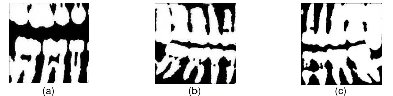 Figure 5. Sample input to the system: (a) a bitewing radiograph (b) a left-cropped panoramic 