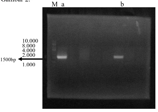 Gambar 2.  Hasil amplifikasi DNA menggunakan PCR 16S rDNA, (a) : isolat LDS 18-5, (b) : LDS 12-4, dan M : Marker 1500 bp