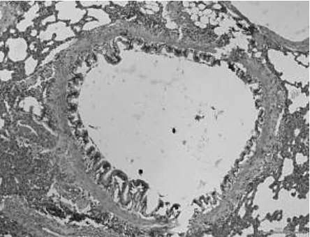 Gambar 1. Foto hasil histologi paru-paru tikus putih (Rattus norvegicus) kontrol positif dengan pembesaran 20x 