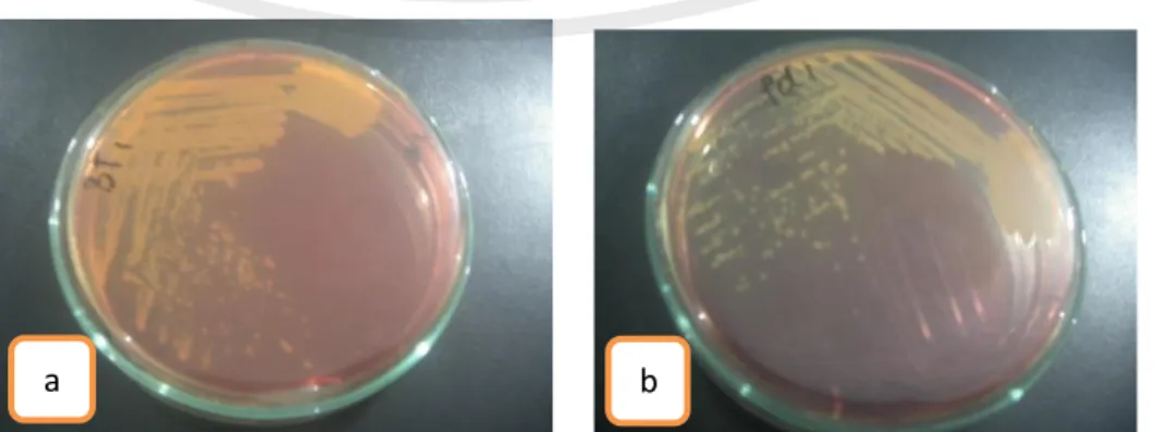Gambar 4.1 Isolat Bakteri Actinomyces viscosus pada media nutrient agar                    a