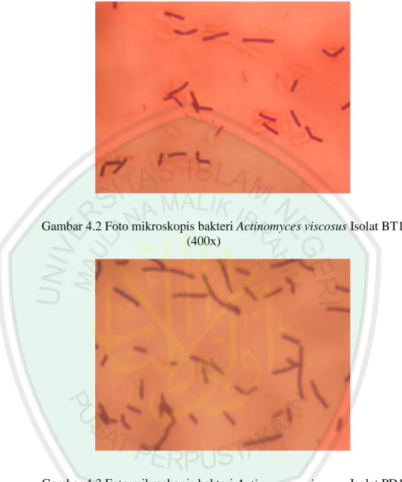 Gambar 4.2 Foto mikroskopis bakteri Actinomyces viscosus Isolat BT1  (400x) 