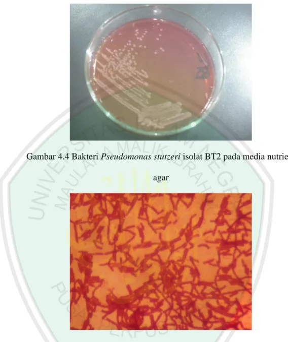 Gambar 4.4 Bakteri Pseudomonas stutzeri isolat BT2 pada media nutrient  agar 