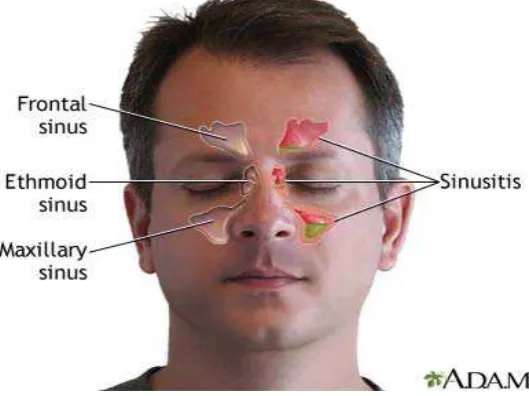Gambar 2.2 : Sinus Paranasalis 