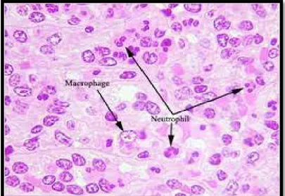 Gambar 5 Sel Makrofag dan Neutrofil (panah hitam) 23 