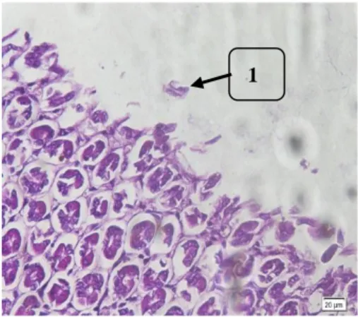 Gambar  2.  Gambaran  histopatologi  lambung  tikus  putih  kelompok  kontrol  positif  (K+)  (Perbesaran  mikroskop  10x)  Keterangan  1
