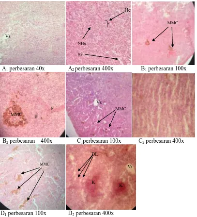 Gambar 8.Struktur mikroanatomi hati ikan nila pada perlakuan kromium dengan berbagai konsentrasi Keterangan : 