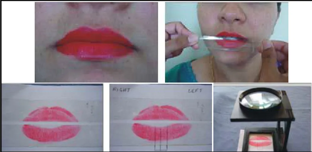 Gambar 7.  Prosedur teknik pengambilan sidik bibir dengan menggunakan metode lipstik. 28