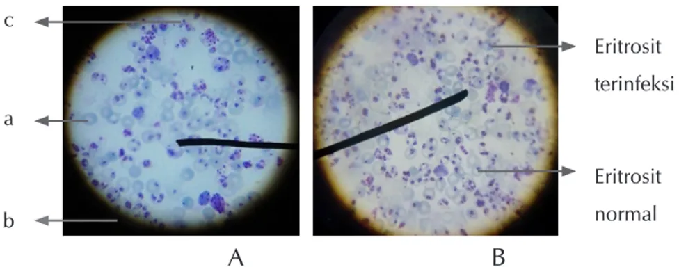 Gambar 3.  Sediaan apusan eritrosit darah mencit indukan (A) mencit terinduksi (B).