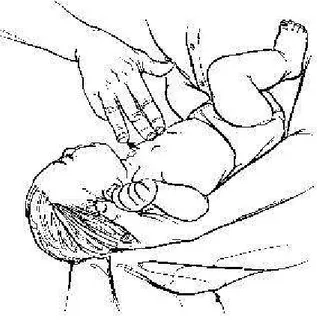 Gambar 2.2  : Tekan dada  1.  Tidurkan klien di pangkuan dengan terlentang.  2.  Pegang leher klien dengan tangan kiri