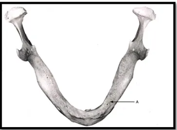 Gambar 1. Puncak dari linggir alveolar (A) umumnya    tersusun dari tulang cancellous 20   