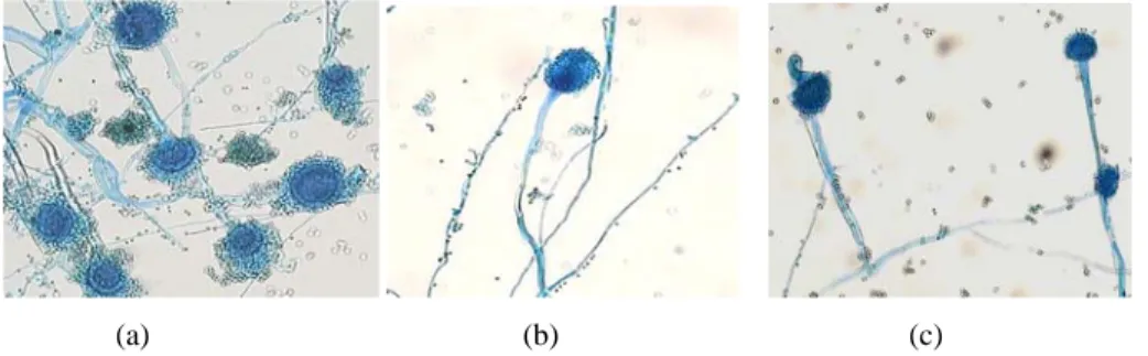 Gambar 3.  Morfologi mikroskopik (perbesaran 400x) A. fumigatus hasil kultur slide pada penyimpanan agar  dalam air suling pada masa penyimpanan 6 bulan (a), dalam kertas saring pada penyimpanan 4  bulan (b), dan dalam kertas saring pada penyimpanan 6 bula