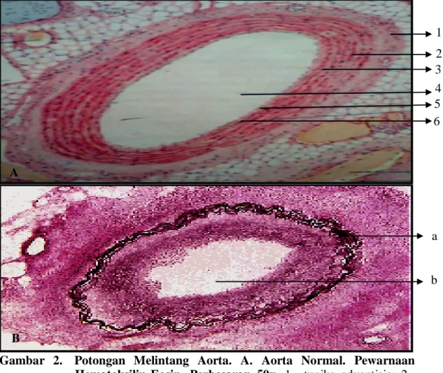 Gambar  2.   Potongan  Melintang  Aorta.  A.  Aorta  Normal.  Pewarnaan              Hematoksilin-Eosin