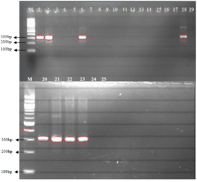 Gambar 2.  Hasil Amplifikasi PCR (Positif Mikrofilaria) Sampel Spot Darah Penderita Kronis dan Positif  Hasil SDJ di Kabupaten Tanjung Jabung Timur Tahun 2014