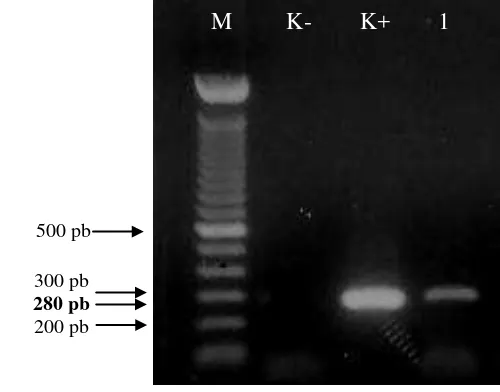 Gambar 11 Hasil visualisasi RT-PCR dengan primer general Potexvirus pada 