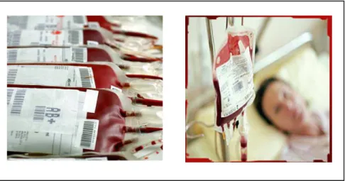 Gambar 4. Transfusi darah yang tercemar HIV 16
