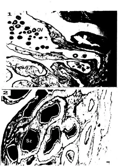 Gambar 2.  Struktur dasar gonad Holothuria forskali. 