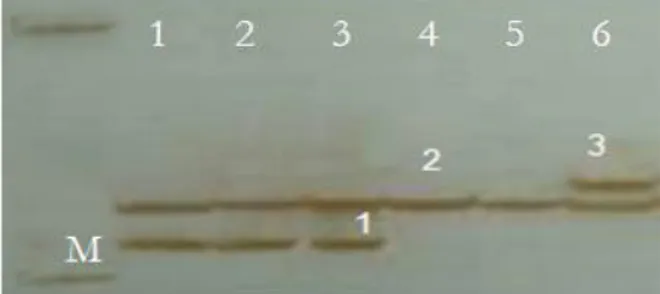 Gambar 1. Contoh pola pita DNA  menggunakan  penanda RFLP 
