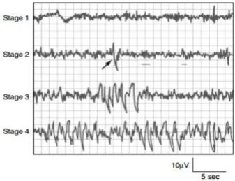 Gambar 1. Karakteristik EEG pada tiap keempat tahapan tidur NREM  (Carskadon &amp; Dement 2011) 