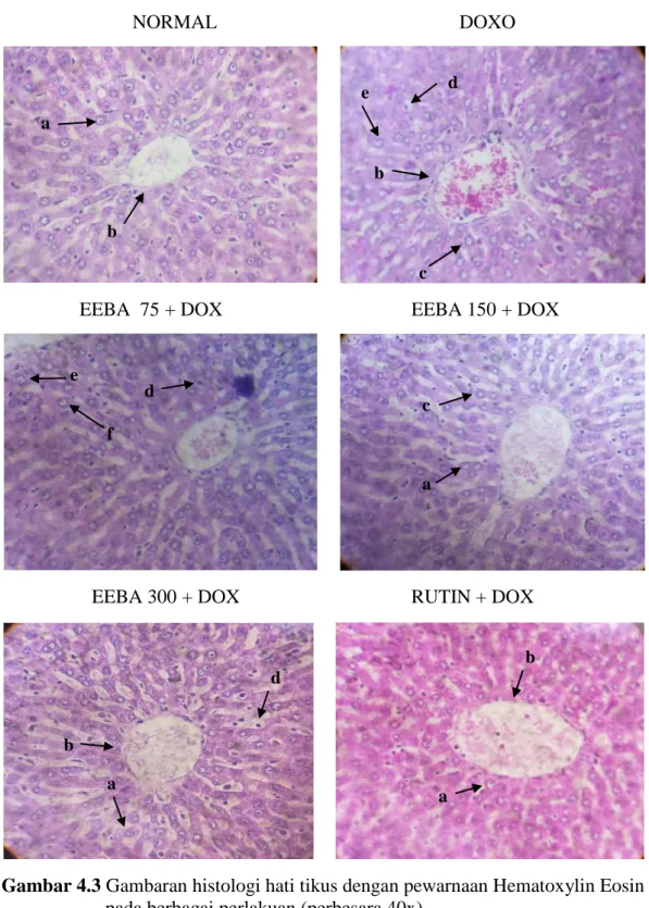Gambar 4.3 Gambaran histologi hati tikus dengan pewarnaan Hematoxylin Eosin  pada berbagai perlakuan (perbesara 40x)  