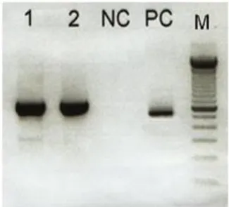 Gambar 1. Hasil Elektroforesis Rt-Pcr Terhadap  Gen H- Ket. 1. Virus Campak Liar; 2. 