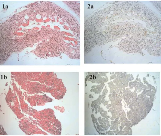Gambar 2. Perbandingan pewarnaan HE (1a dan 2a) dengan pewarnaan imunohistokimia (1b dan 2b) pada organ yang sama