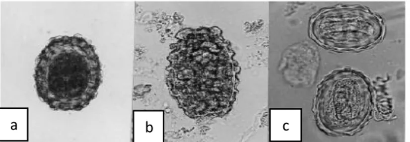 Gambar 2.2. Telur A. lumbricoides. a. telur fertil pada feses, b.  telur infertil, c. second-stage dari larva infektif di dalam telur 