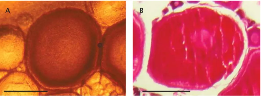 Figure 2. Stage 2 of the intraovarian oocytes based on biopsy (A) and histological slide (B) samples (bar scale= 0.1 mm)