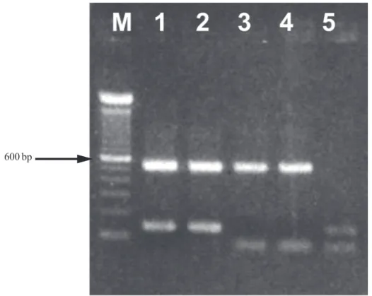 Gambar 1. RT-PCR hasil amplifikasi NCR ujung -5 dan  amino terminus gen PB2 dari  virus AI H5N1 isolat lokal dalam gel agarose 1% dan divisualisasikan dengan ethidium bromide dan sinar ultraviolet