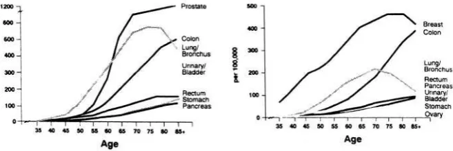 Figure 1. The incidence of common cancers increases with age.