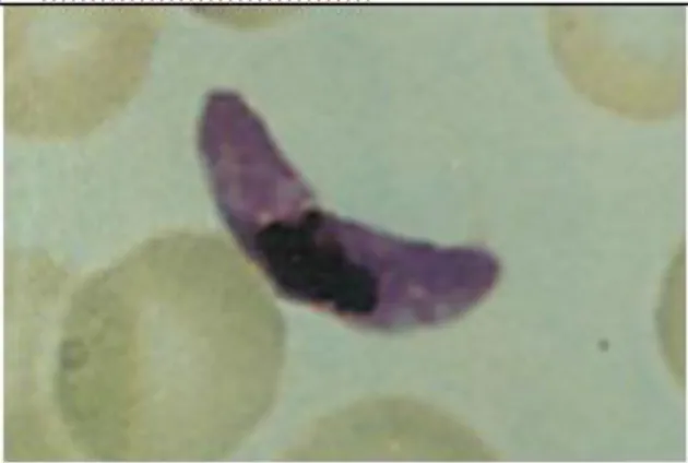 Gambar 4. Bentuk makrogametosit Plasmodium falciparum  dengan perbesaran 100x (Sumber: Prianto dkk, 2010) 
