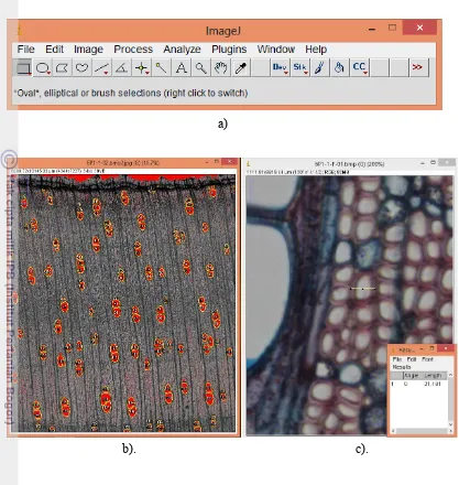 Figure 7 a) ImageJ software. b) Vessel frequency measurement. c) Fiber diameter, 