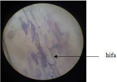 Gambar 1. Hifa pada Fungi Mikoriza Arbuskula 