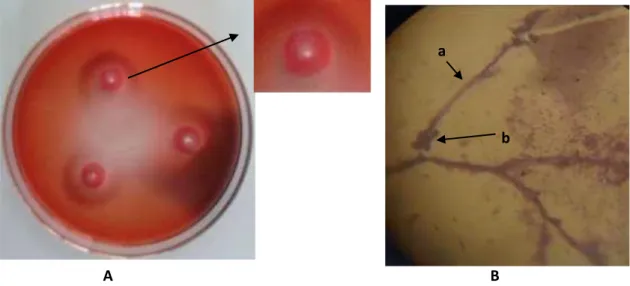 Gambar 3. (A) Koloni Streptomyces sp.3. (B) Struktur mikroskopik a Hifa b. konidia perbesaran 1000x 