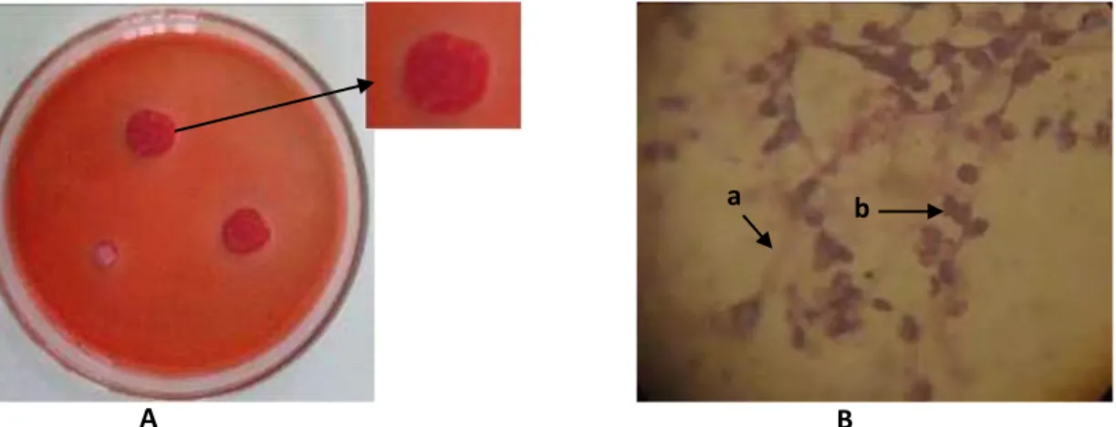 Gambar 5 (A) Koloni Streptomyces sp.5. (B) Struktur mikroskopik a Hifa b. konidia perbesaran 1000x  f