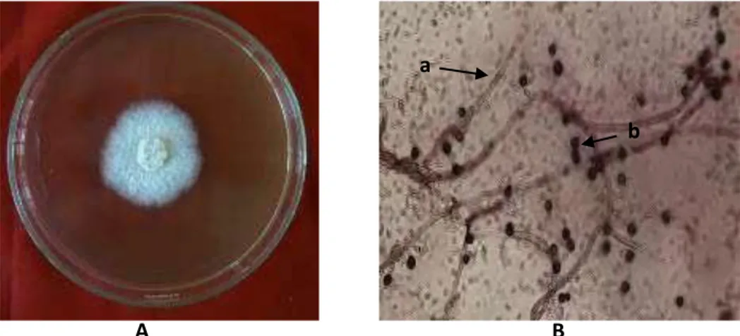 Gambar 8 (A) Koloni Streptomyces sp.8. (B) Struktur mikroskopik a Hifa b. konidia perbesaran 1000x 