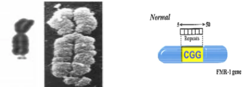 Gambar 1 :   Kromosom dengan fragile X dan Gen FMR-1 dengan pengulangan basa  CGG 5 – 50         (http//www.fragilex.org/html/what.htm) 