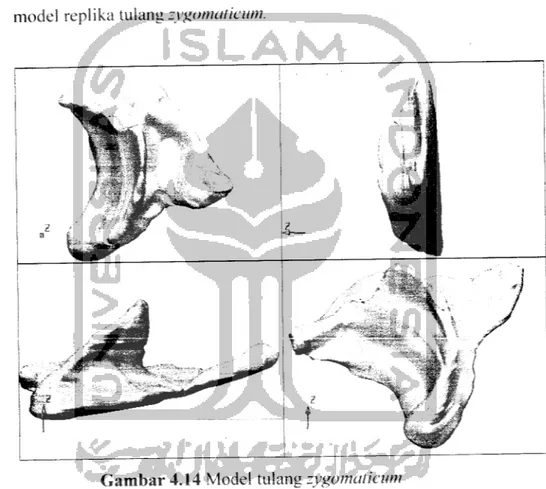 Gambar 4.14 Model tulang zygomaticum