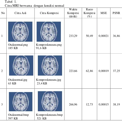 Tabel  1.  Citra MRI berwarna  dengan kondisi normal  