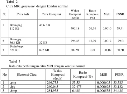 Tabel  2. Citra MRI grayscale  dengan kondisi normal  