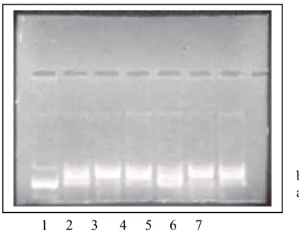 Gambar 1. Pemotongan DNA superkoil  oleh fraksi 60% dan 80 %.(1)  DNA superkoil utuh (kontrol negatif),  (2)  1,5 mg/ml protein ekstrak gubal,(3)  protein  1,5 mg/ml protein fraksi pengendapan 60 %, (4)  1,5 mg/ml protein fraksi pengendapan 80 %, (5)  mg/m