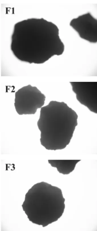 gambar 1. Dari foto mikroskop terlihat bahwa  mikropartikel yang dihasilkan secara umum dapat  dikatakan bahwa mikroparikel teofilin-chitosan  yang dihasilkan dari ketiga formula memiliki  bentuk yang sferis  tetapi permukaan dari  mikropartikel kurang hal