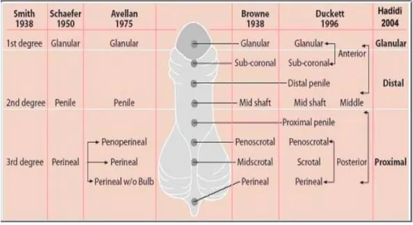 Gambar 2.2.Klasifikasi hipospadia berdasarkan lokasi meatus uretra  eksterna (dikutip dari Hadidi, 2004)