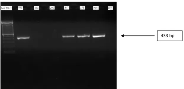 Gambar 1 : Elektroforesis produk PCR menggunakan gel agarose mendeteksi adanya pita sebesar 433 bp untuk gen pvl