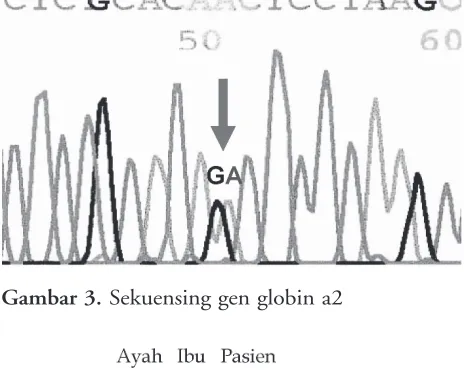 Gambar 3. Sekuensing gen globin a2