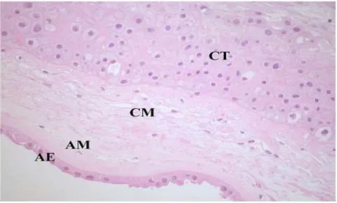 Gambar 2.2 Mikroskopik selaput ketuban pewarnaan Haematoxylin- Haematoxylin-Eosin  (HE)  (AE:  amniotic epithelial layer, AM: amniotic  mesenchymal layer, CM: chorionic mesenchymal layer, CT: 