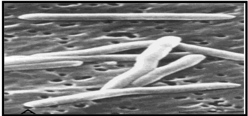 Gambar 2. Koloni Fusobacterium nucletum dibawah    Electrom Microscopy (EM) 4  