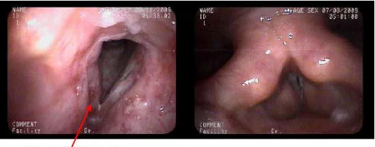 Gambar 2.3 Eritemia/ hiperemia (Pham 2009) 